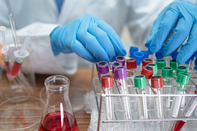 Koja biljka pomaže u lečenju raka? Naučnici su otkrili